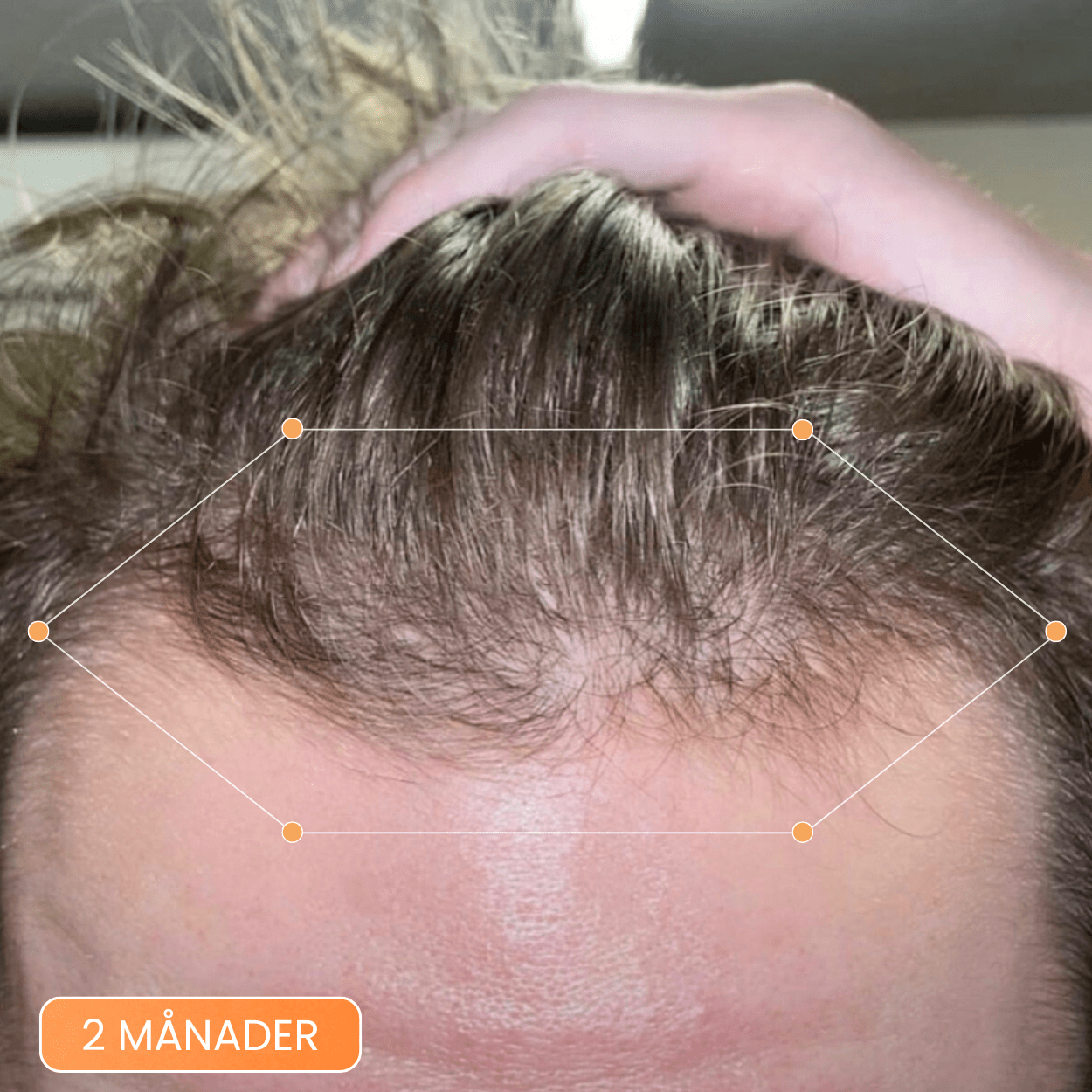 Hair Growing Scalp Serum