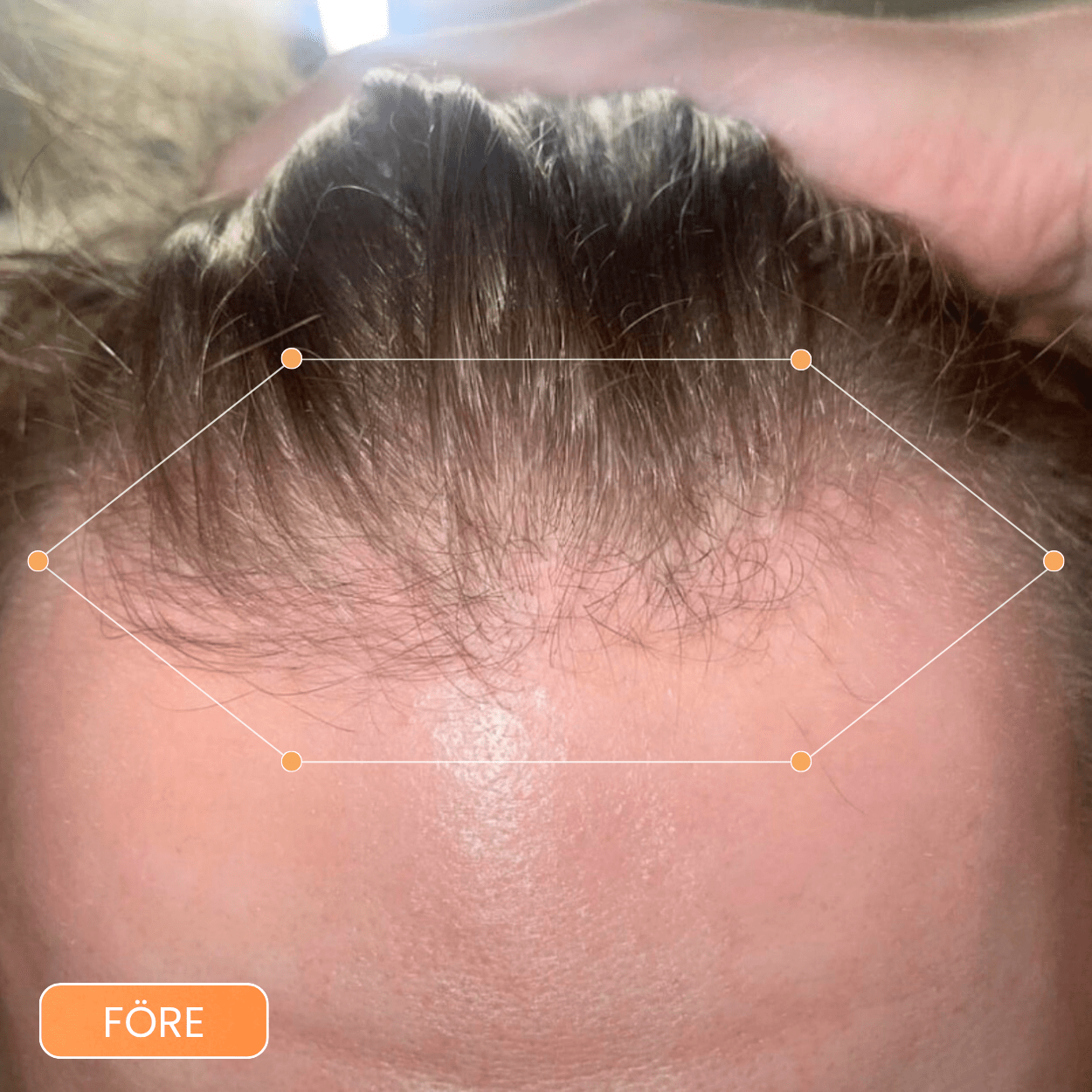 Hair Growing Scalp Serum