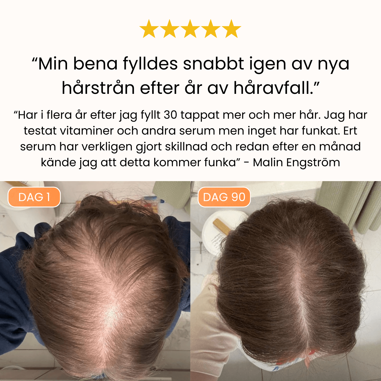 Hair Growing Scalp Serum