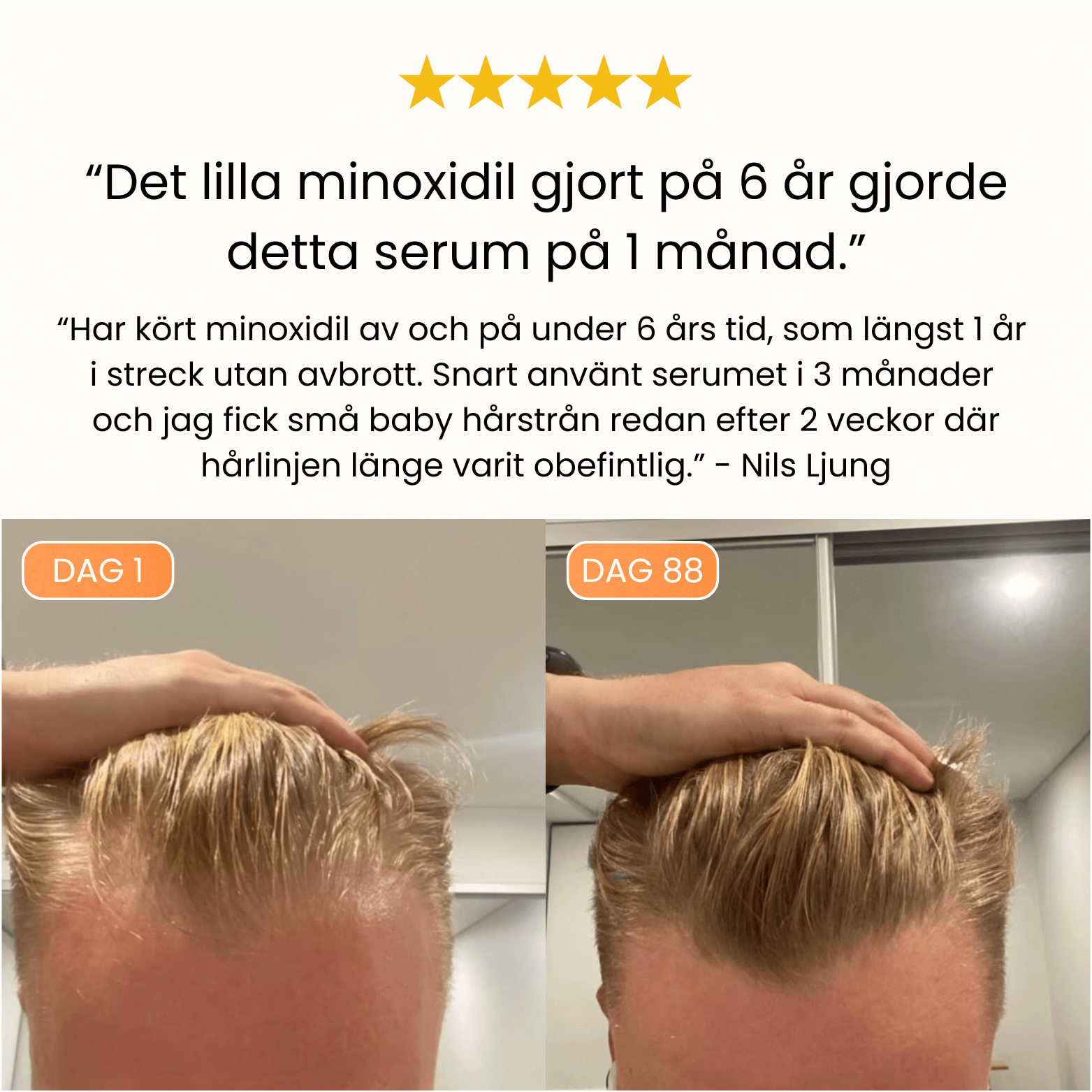 Hair Growing Scalp Serum